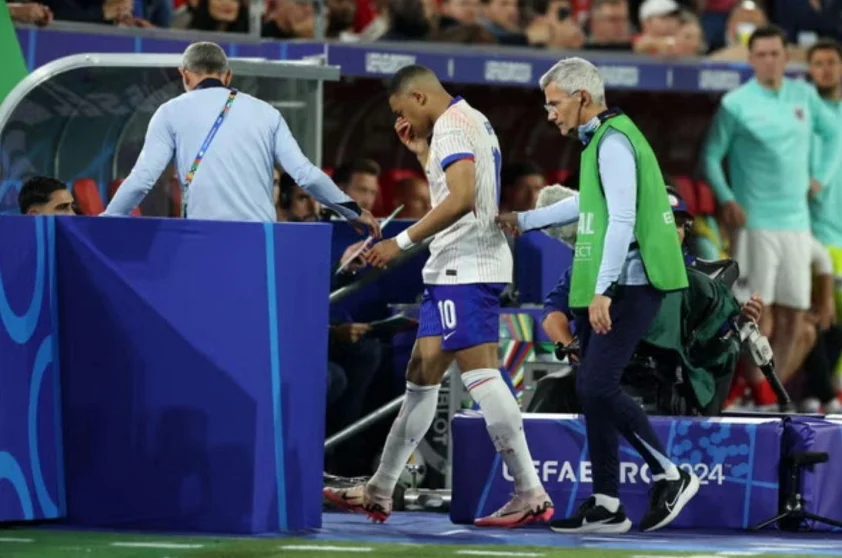 Cận cảnh chấn thương khiến mũi Mbappe "gãy làm đôi" 4 6670aa5830713