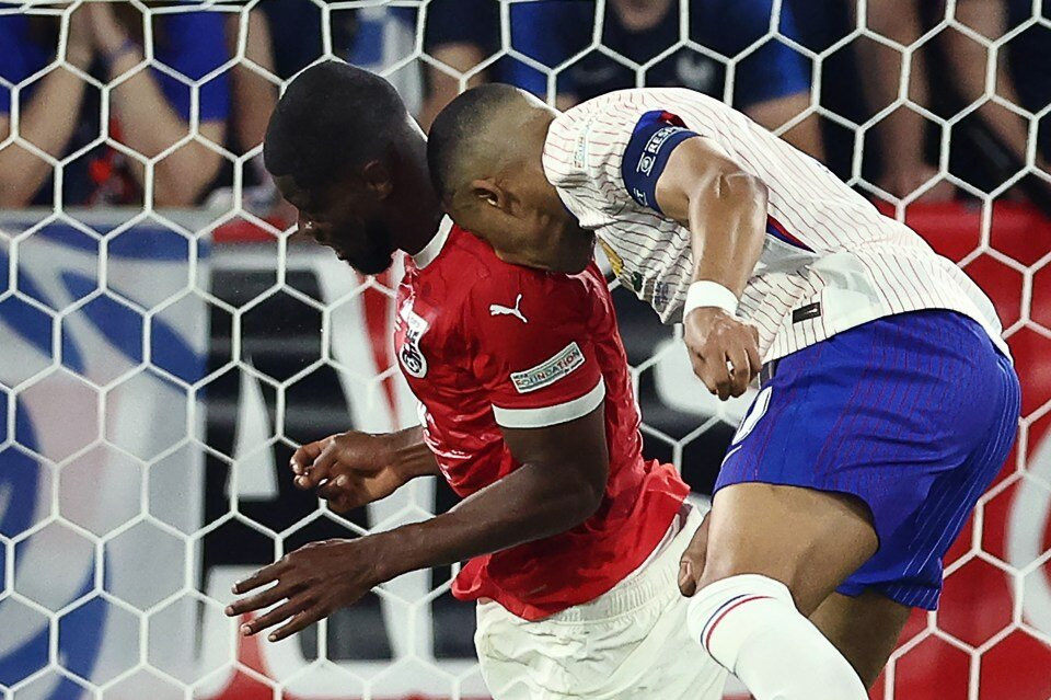 Cận cảnh chấn thương khiến mũi Mbappe "gãy làm đôi" 1 mbappe 230
